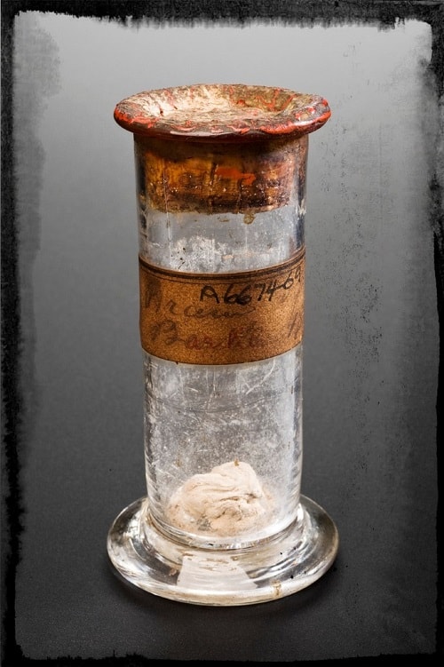 Specimen Jar Containing piece of William Burke's Brain From the Science Museum London via Wellcome Images