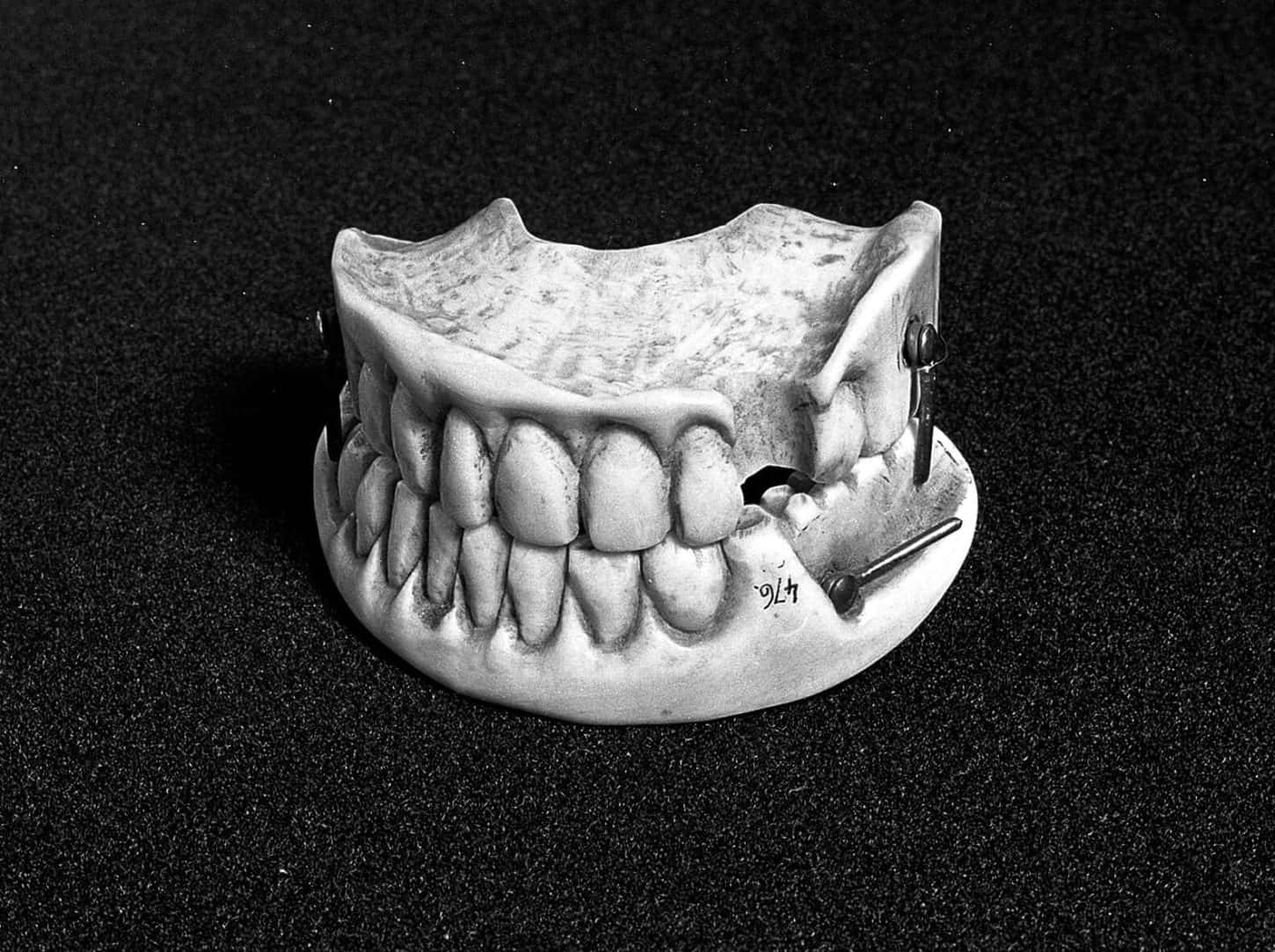 Dentures made from Waterloo Teeth 