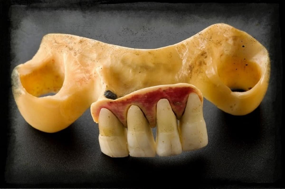 Waterloo Teeth Lower denture with human teeth, England, 1800-1870 Science Museum via Wellcome Library